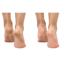 Anti-Fuss- und Nagelpilzspray, 100 ml