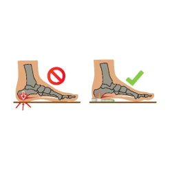 Fersenspornkissen, 1 Paar