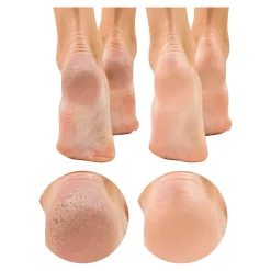 Horn-und Nagelhaut-Entferner, 200 ml