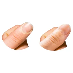 Horn-und Nagelhaut-Entferner, 200 ml