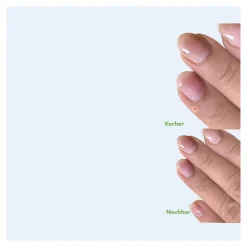 Warzen-Ex Tinktur, 2 ml