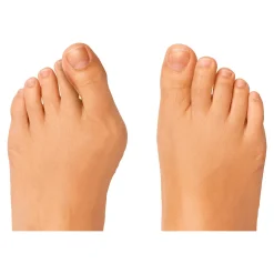 Zehen-Distanz-Schiene, 2 Stück