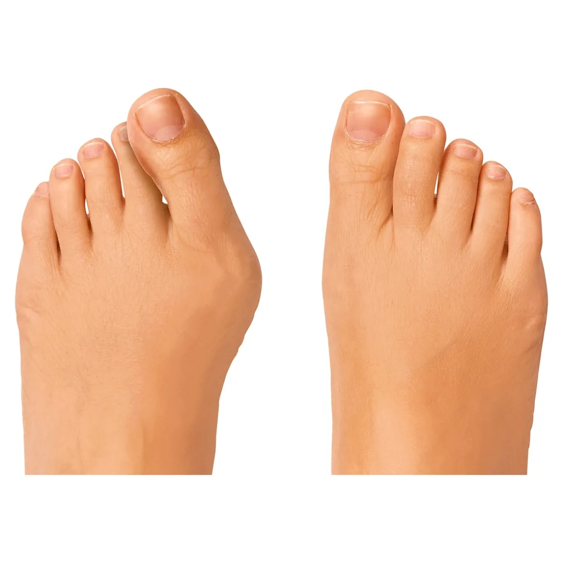 Zehen-Distanz-Schiene, 2 Stück